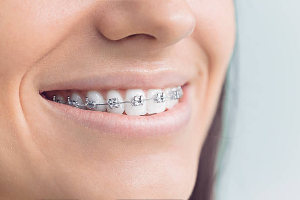 Best Wisdom Tooth Removal  in Barclay, NJ